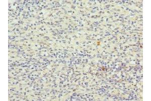 Immunohistochemistry of paraffin-embedded human spleen tissue using ABIN7148893 at dilution of 1:100