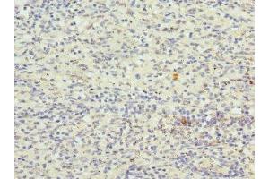Immunohistochemistry of paraffin-embedded human spleen tissue using ABIN7148893 at dilution of 1:100 (CDKN2D anticorps  (AA 1-166))