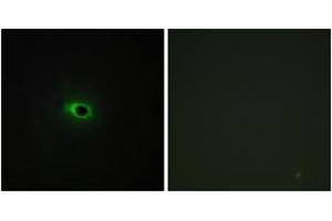 Immunofluorescence (IF) image for anti-Collagen, Type XII, alpha 1 (COL12A1) (AA 1481-1530) antibody (ABIN2889923) (COL12A1 anticorps  (AA 1481-1530))