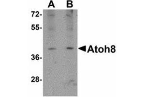 Image no. 1 for anti-Atonal Homolog 8 (ATOH8) (C-Term) antibody (ABIN478063) (ATOH8 anticorps  (C-Term))