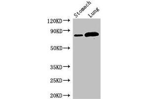 Western Blot Positive WB detected in: Mouse stomach tissue, Rat lung tissue All lanes: SLC3A1 antibody at 2. (SLC3A1 anticorps  (AA 1-68))