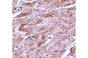 Immunohistochemistry (IHC) image for anti-Transient Receptor Potential Cation Channel, Subfamily C, Member 3 (TRPC3) (N-Term) antibody (ABIN1031644) (TRPC3 anticorps  (N-Term))