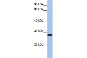 WB Suggested Anti-VDAC3 Antibody Titration: 0. (VDAC3 anticorps  (N-Term))