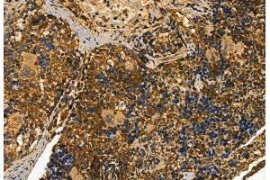 ABIN6258949 and ABIN6273453 at 1/100 staining Rat spleen tissue by IHC-P. (CD81 anticorps  (Internal Region))