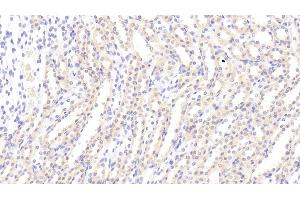 Detection of AXL in Rat Kidney Tissue using Polyclonal Antibody to AXL Receptor Tyrosine Kinase (AXL) (AXL anticorps  (AA 21-202))