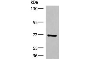 Western blot analysis of HepG2 cell lysate using PAPSS2 Polyclonal Antibody at dilution of 1:1000