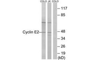 Western blot analysis of extracts from COLO/Jurkat cells, using Cyclin E2 (Ab-392) Antibody. (Cyclin E2 anticorps  (AA 355-404))