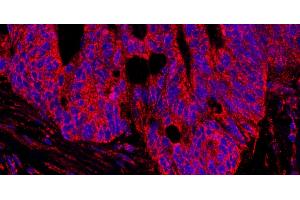 anti-A Kinase (PRKA) Anchor Protein 1 (AKAP1) (AA 375-425) antibody