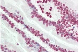 Human Small Intestine: Formalin-Fixed, Paraffin-Embedded (FFPE) (TLE4 anticorps  (N-Term))