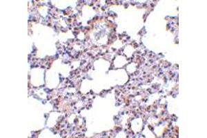 Immunohistochemistry of TRPC6 in mouse lung tissue with TRPC6 polyclonal antibody  at 10 ug/mL .
