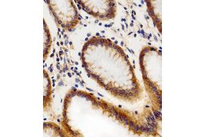 Immunohistochemical analysis of paraffin-embedded H. (CHML anticorps  (C-Term))