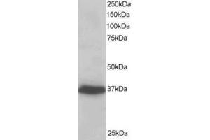Image no. 1 for anti-PDZ and LIM Domain 4 (PDLIM4) (C-Term) antibody (ABIN374397) (PDLIM4 anticorps  (C-Term))