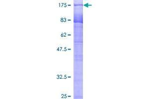 Image no. 1 for Poly-U Binding Splicing Factor 60KDa (PUF60) (AA 1-516) protein (GST tag) (ABIN1316910)