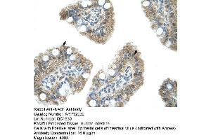 Human Intestine (NAB1 anticorps  (N-Term))