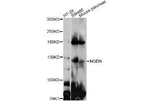 Western blot analysis of extracts of various cell lines, using GUCY2C antibody (ABIN4903854) at 1:1000 dilution.