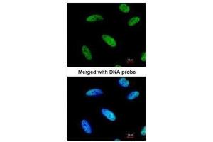 ICC/IF Image Immunofluorescence analysis of paraformaldehyde-fixed HeLa, using DNAJC7, antibody at 1:200 dilution.