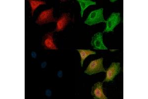 MKK3/MKK6 Antibody staining A549 cells(H2O2 treatment) by IF/ICC. (MAP2K3 anticorps)