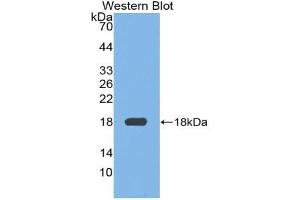 Western blot analysis of the recombinant protein. (Fibronectin anticorps  (AA 2117-2236))