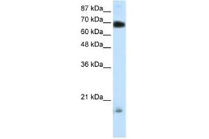 Human 293T; WB Suggested Anti-TRIM32 Antibody Titration: 0. (TRIM32 anticorps  (C-Term))