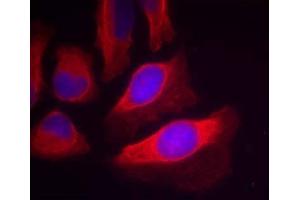 Immunofluorescence staining of methanol-fixed HeLa cells using IKK-β (Phospho-Tyr199) Antibody (E011305, Red) (IKBKB anticorps  (pTyr199))