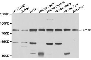 Western blot analysis of extracts of various cell lines, using SP110 antibody (ABIN4905277) at 1:1000 dilution. (SP110 anticorps)