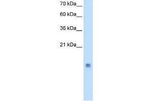 Cystatin B antibody used at 0.