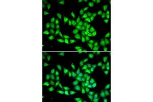 Immunofluorescence analysis of HeLa cells using PCMT1 antibody. (PCMT1 anticorps  (AA 62-286))