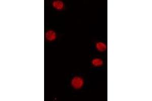 ABIN6267035 staining HeLa cells by IF/ICC.
