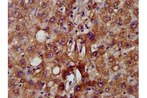 IHC image of ABIN7160839 diluted at 1:500 and staining in paraffin-embedded human liver tissue performed on a Leica BondTM system.