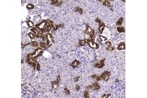 IHC analysis of CKB using anti-CKB antibody .