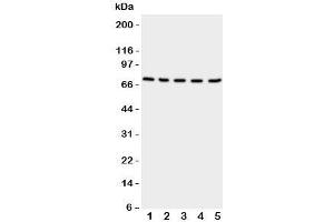 Western blot testing of NRG1 antibody and Lane 1: rat spleen;  2: (r) kidney;  3: (r) brain;  4: human HeLa;  5: (h) SMMC-7721 cell lysate (Neuregulin 1 anticorps  (C-Term))