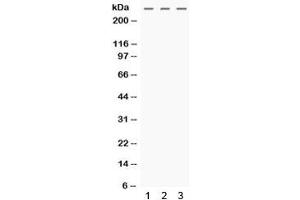 Western blot testing of human 1) HeLa, 2) MCF7 and 3) SW620 cell lysate with MGA antibody. (MGA anticorps)