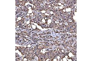 IHC analysis of SNRPD2 using anti-SNRPD2 antibody (ABIN7598963). (SNRPD2 anticorps  (AA 1-118))