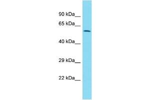 Host:  Rabbit  Target Name:  ZNF671  Sample Type:  Uterus Tumor lysates  Antibody Dilution:  1. (ZNF671 anticorps  (C-Term))
