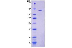 SDS-PAGE (SDS) image for Cytochrome P450, Family 17, Subfamily A, Polypeptide 1 (CYP17A1) (AA 183-508) protein (His tag) (ABIN6239047)