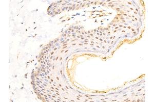 ABIN6267283 at 1/100 staining human skin tissue sections by IHC-P.