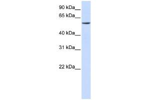 WB Suggested Anti-ZNF358 Antibody Titration: 0. (ZNF358 anticorps  (C-Term))