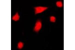 Immunofluorescent analysis of DGK iota staining in HeLa cells. (DGKI anticorps  (C-Term))