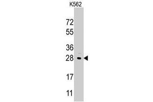 Western blot analysis of LIN28B polyclonal antibody  in K-562 cell line lysates (35 ug/lane).