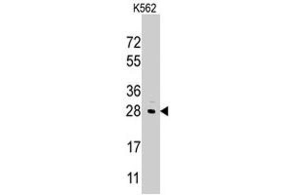 LIN28B anticorps  (Internal Region)