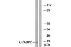 Western blot analysis of extracts from HT-29 cells, using CRABP2 Antibody. (CRABP2 anticorps  (AA 41-90))