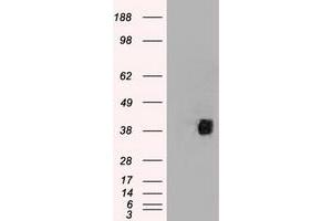 HEK293T cells were transfected with the pCMV6-ENTRY control (Left lane) or pCMV6-ENTRY CD2 (Right lane) cDNA for 48 hrs and lysed. (CD2 anticorps)