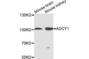 Western blot analysis of extracts of various cells, using ADCY1 antibody. (ADCY1 anticorps)