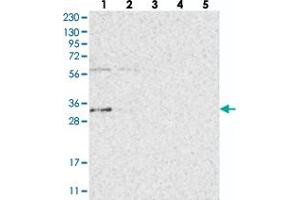Western blot analysis of Lane 1: RT-4, Lane 2: U-251 MG, Lane 3: Human Plasma, Lane 4: Liver, Lane 5: Tonsil with ZFAND2B polyclonal antibody  at 1:250-1:500 dilution.
