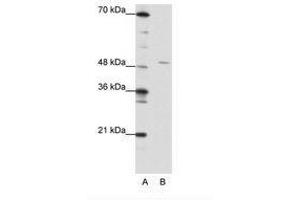 Image no. 1 for anti-High-Mobility Group 20A (HMG20A) (AA 181-230) antibody (ABIN202299) (HMG20A anticorps  (AA 181-230))