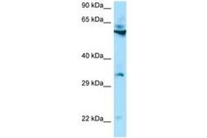 Image no. 1 for anti-Transmembrane Protein 192 (TMEM192) (AA 60-109) antibody (ABIN6748451)