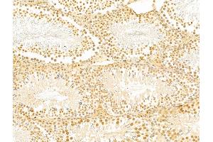 anti-GA Repeat Binding Protein, beta 1 (GABPB1) (Internal Region) antibody