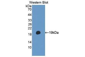 Western blot analysis of the recombinant protein. (TSC22D3 anticorps  (AA 1-137))