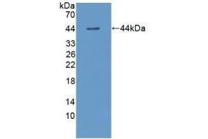 Western blot analysis of recombinant Dog TSHb. (TSHB anticorps  (AA 20-138))