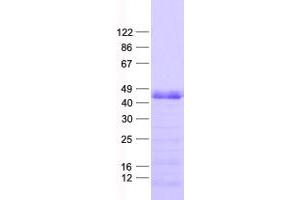 Validation with Western Blot (PHF6 Protein (His tag))